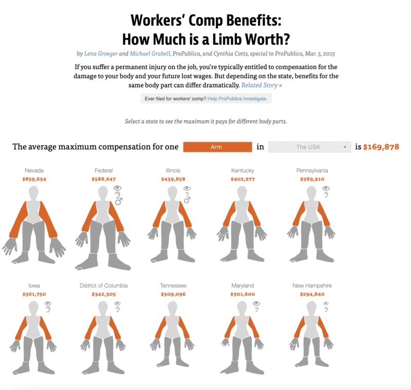 ‣ MyFixitUpLife ProPublica-Body-Parts-Value-Workers-Comp value of arms